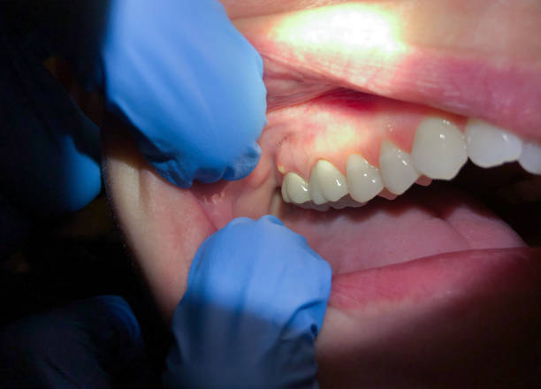 Best Broken or Cracked Tooth Emergency Dentist in Atwater, CA